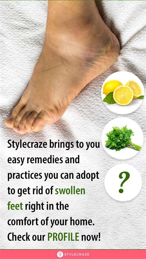 16 Effective Home Remedies For Swollen Feet