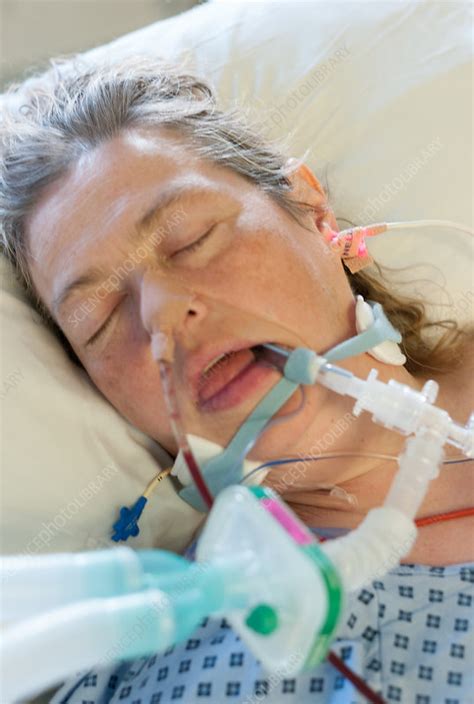 Woman On A Ventilator In Intensive Care Stock Image C0509973