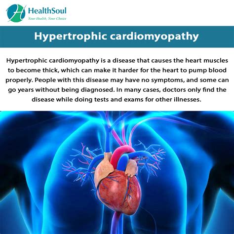 Hypertrophic Cardiomyopathy Healthsoul