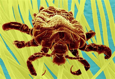 Pubic Louse Photograph By E Gray Science Photo Library