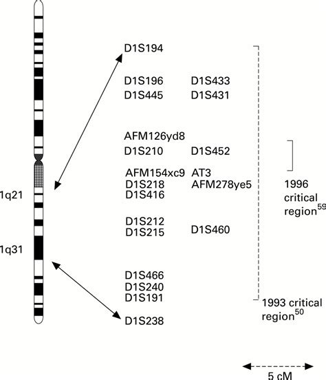 The Genetics Of Primary Open Angle Glaucoma British Journal Of