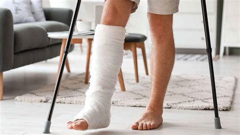 4 Signs To Know If You Have A Broken Leg Kingwood Emergency Hospital