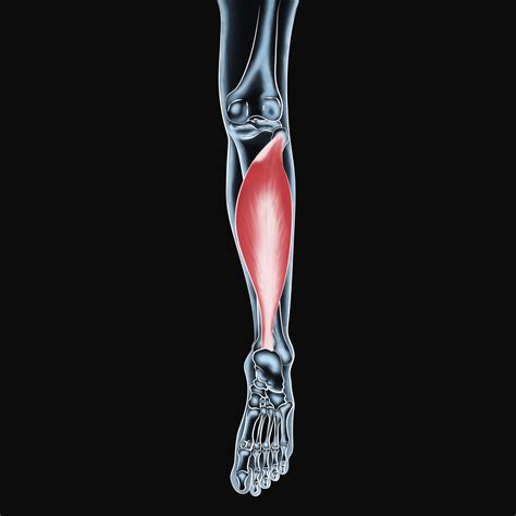 Soleus Muscle Injuries Optimal Recovery Techniques