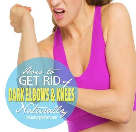 👯how To Get Rid Of Dark Elbows And Knees Naturally👯 Beauty Skin