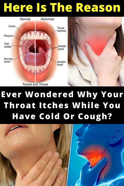 Ever Wondered Why Your Throat Itches While You Have Cold Or