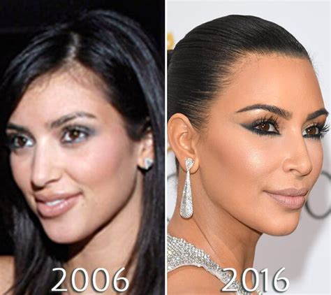 Kim Kardashian Nose Before And After Photo Kardashian Plastic Surgery
