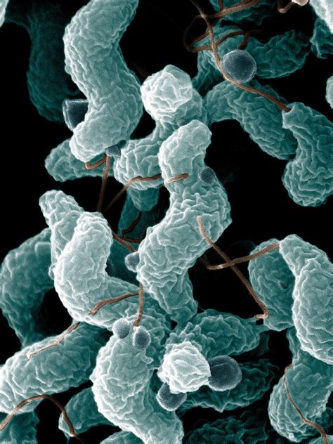 Campylobacter Concise Medical Knowledge