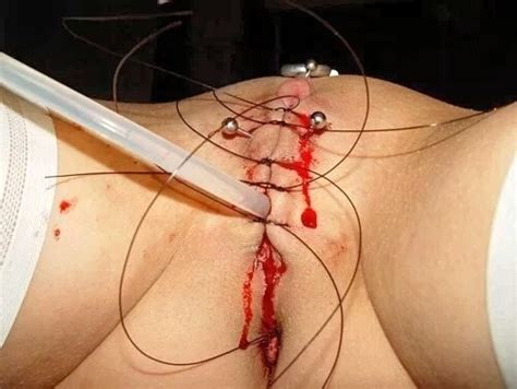 Thumbs Pro Pussymodsgalore Bdsm Pain Games A Catheter Is Inserted Into Her Bladder So That
