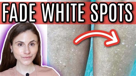 How To Fade White Spots From Sun Damage Dr Dray Youtube