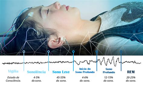 Polissonografia O Exame Capaz De Diagnosticar Dist Rbios Do Sono