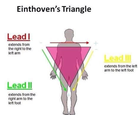 Einthovens Triangle Enfermera Triangulos