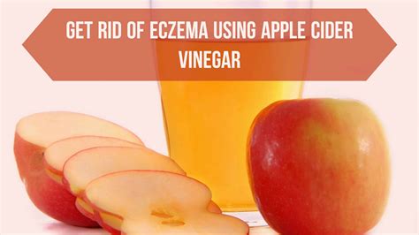 How To Get Rid Of Eczema Using Apple Cider Vinegar