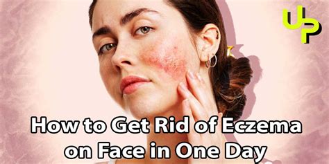 How To Get Rid Of Eczema On Face In One Day Utilize Point
