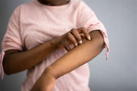 50 Black Woman Itch Arm Stock Photos Pictures And Royalty Free Images