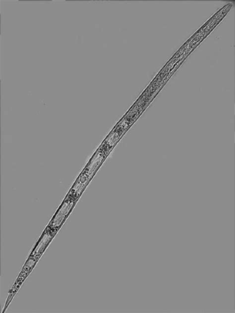 https://www.researchgate.net/figure/Second-stage-juvenile-left-and-perineal-pattern-right-of-Meloidogyne-javanica_fig1_292152894