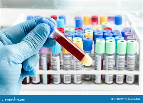 Laboratory Technician Holding A Blood Tube Test Stock Photo Image