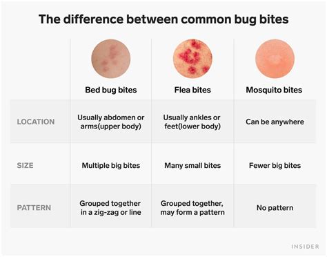 Common Bed Bug Bites Pest Phobia