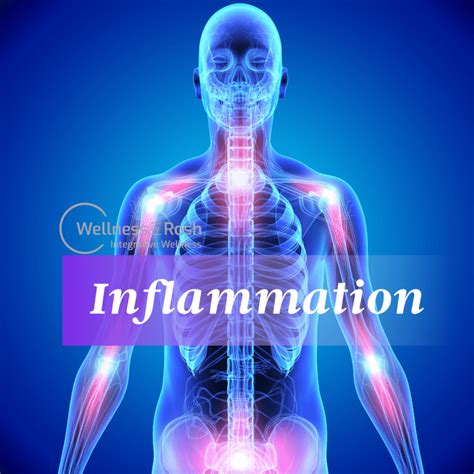 Inflammation Friend Or Enemy Wellness By Rosh Integrative Wellness