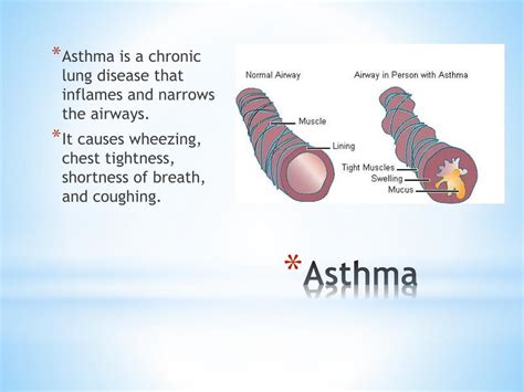 Ppt Asthma Powerpoint Presentation Free Download Id2668156