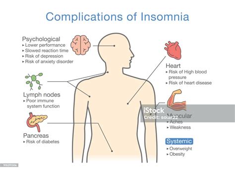 Diagramme Des Complications De Linsomnie Vecteurs Libres De Droits Et