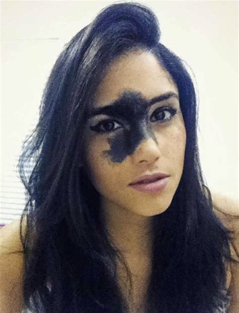 Model Mariana Mendes Says Facial Birthmark Makes Her Unique And Refuses