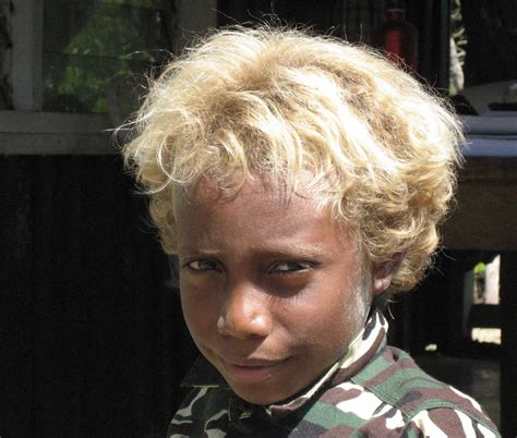 Another Genetic Quirk Of The Solomon Islands Blond Hair The New York Times