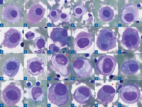 The Panorama Of Different Faces Of Mesothelial Cells Basicmedical Key