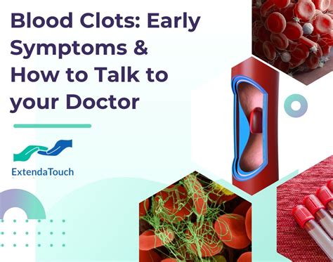 Blood Clot Symptoms What To Watch Out For And When To See A Doctor