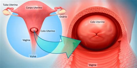 Aprender Sobre 90 Imagem Colo Do Utero No Inicio Da Gravidez Fotos Vn