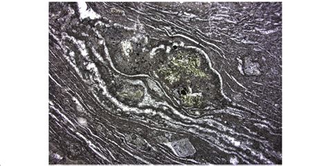 Thin Section Showing An Eutaxitic Texture From A Densely Welded