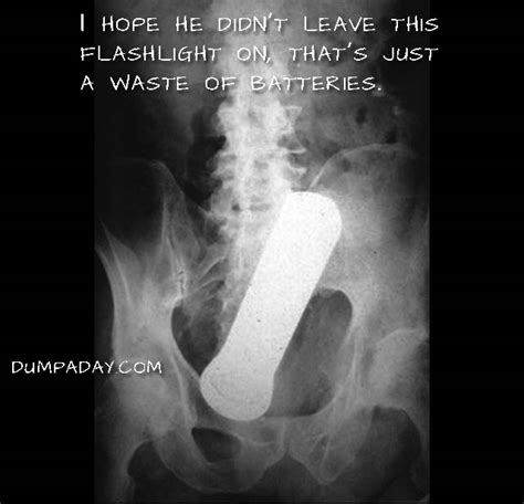 Amazing X Rays Of Random Objects Inserted Into Bizarre Places Pics