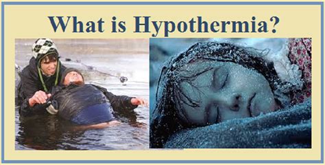 Hypothermia Symptoms Causes Risk Factors Prevention And Treatment