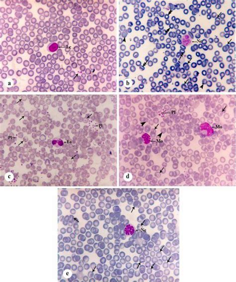 Photomicrographs Showing Peripheral Blood Smears Of Mice In Different
