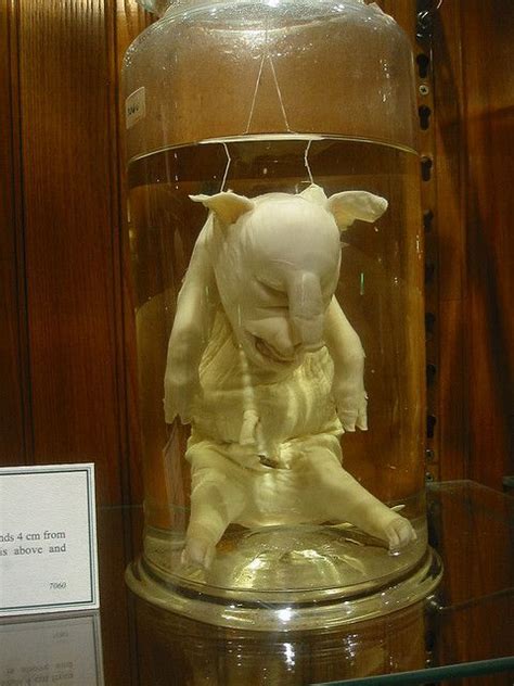 19 Best Mutter Museum Of Medical Oddities Images On Pinterest Medical