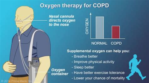 Oxygen Therapy For Copd Animated Copd Patient Management Therapy