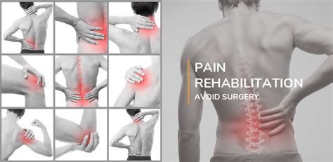 Pain Rehabilitation Treat Pain Without Surgery Physioline