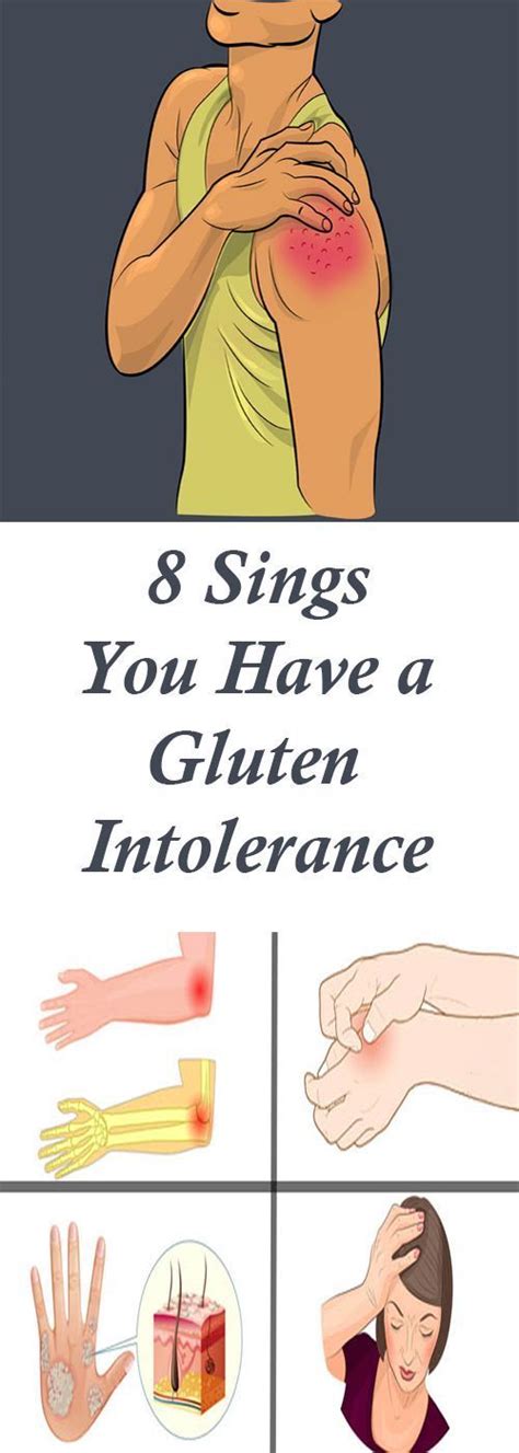The Most Common Signs Of Gluten Intolerance Health Hacks