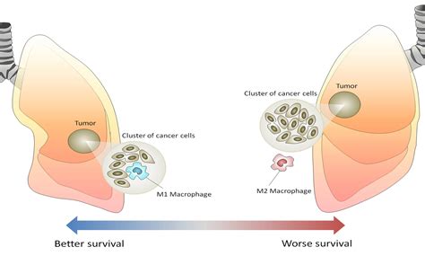 The Many Faces Of Macrophages In Lung Cancer Atlas Of Science