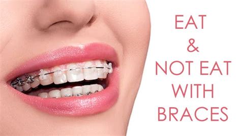 what can you eat and not eat with braces by cape town orthodontist medium