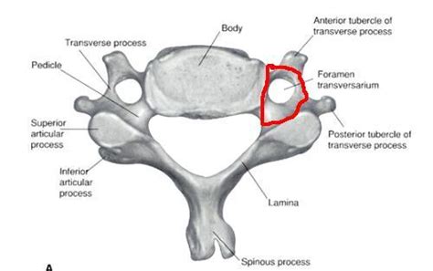 Transverse Foramen Fractures Bone And Spine