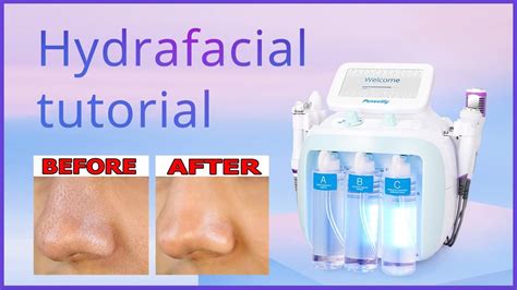 Hydrafacial Tutorial How To Use Hydrafacial Skin Care Treatment Step By Step Youtube