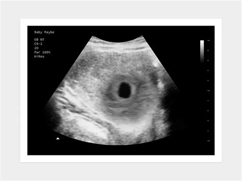 Early Miscarriage Fake Ultrasound W Instant Download