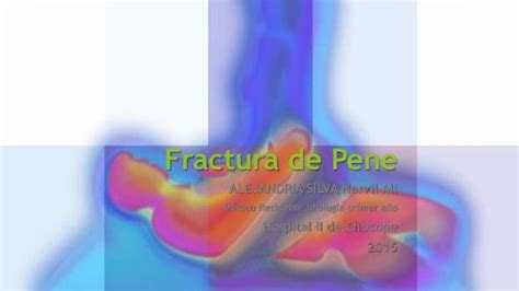 Fractura De Pene