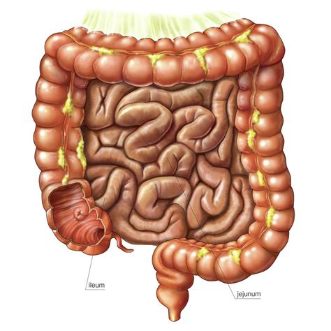 Small Intestine Photograph By Asklepios Medical Atlas Porn Sex Picture
