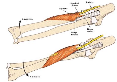 Elbow Kaplan Approach Approaches Orthobullets