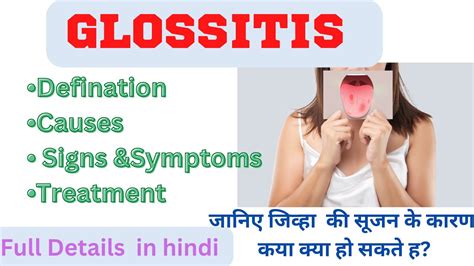 Glossitisdefinition Causes Signandsymptoms Treatment Glossitis Full