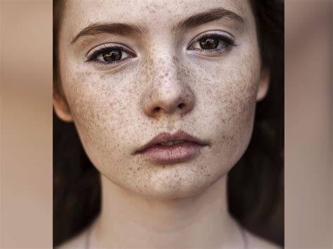 How To Get Rid Of Your Freckles Top Secret Skin Tips