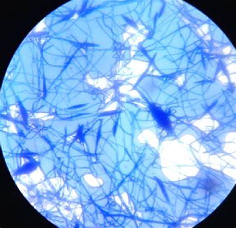 Microscopic Appearance Of Microsporum Audouinii Macroconidia Some Are