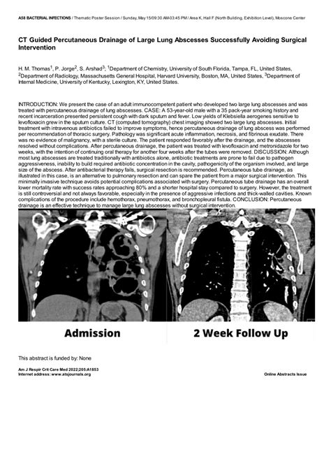 Pdf Ct Guided Percutaneous Drainage Of Large Lung Abscesses