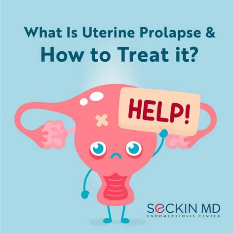 What Is Uterine Prolapse And How To Treat It